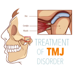 How Much Does a TMJ Surgery Cost? (2022)