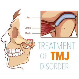 TMJ disorder diagram