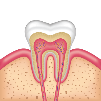 Root Canal cost