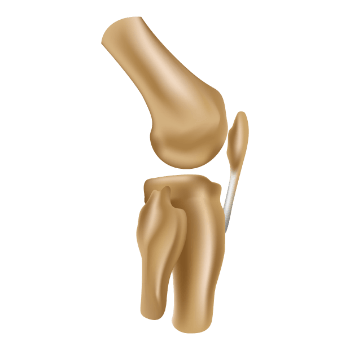 broken vector image of knee