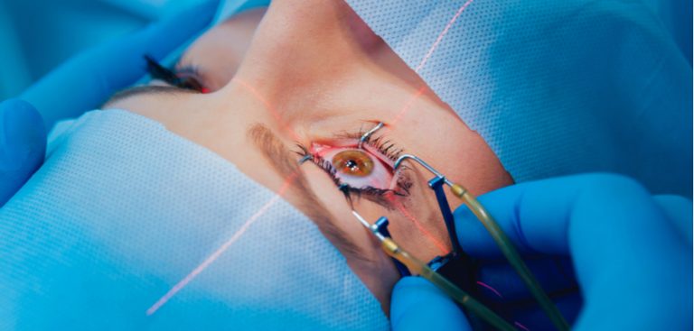 What Does Vsp Cover For Lasik