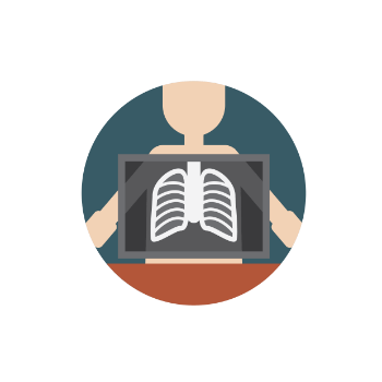 chest xray showing lungs
