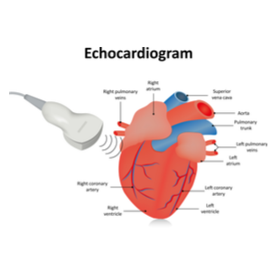 Echocardiogram vector
