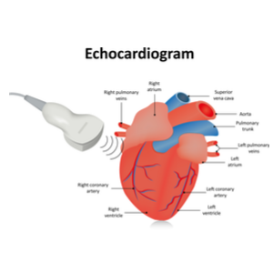 How Much Does an Echocardiogram Cost? (2022)