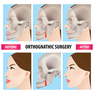 how much does jaw surgery cost for a dog